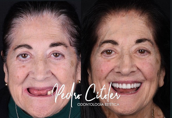 Pedro Citoler Odontología Estética, premio Clínica Dental Excelente en España