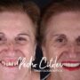 La experiencia del paciente: define el éxito de una clínica dental
