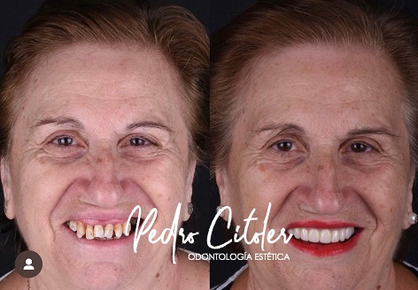 La experiencia del paciente ya define el éxito de una clínica dental
