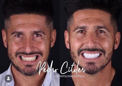 MEJOR CLÍNICA DENTAL DE ESPAÑA