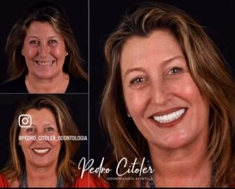 Lo que las clínicas dentales más reconocidas de España hacen cuando nadie las está mirando