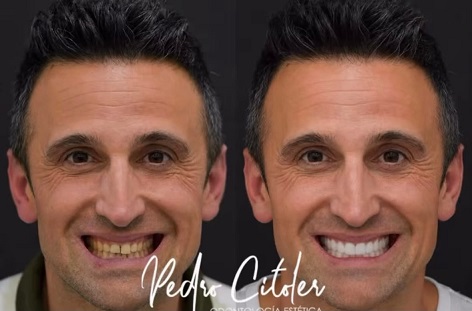 La tecnología se democratiza. Descubra por qué el verdadero diferencial de las clínicas dentales del futuro será disponer de un método propio y protocolos clínicos bien definidos.
